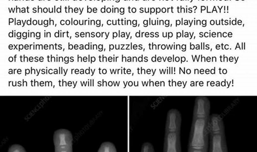 Boost Fine Motor: Tracing Therapy for Hand Muscle Development Skills